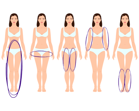 Quais os tipos de Lipedema?